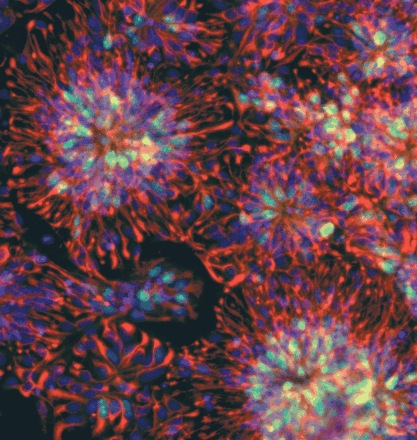 Human embryonic stem cells growing in a culture dish