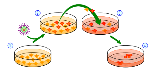 Overview of the process of making IPSC cells from skin cells. 1) Skin cells are grown in a dish and treated (2) with genes necessary to change them into stem cells. (3) A subset of treated cells will receive the message to become induced pluripotent stem cells (4).