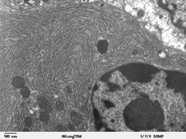 Våglinjerna i denna bild är det "endoplasmiska retiklet" i en cell - kalciumförrådet. Ryanodinreceptorerna sitter på dessa.  